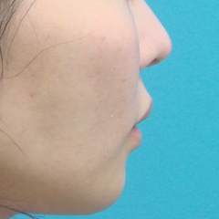 2014_05_13_012816.JPG