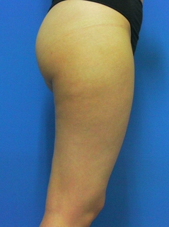 2012_0424_161624AB.JPG