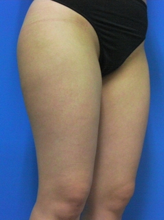 2012_0424_161635AB.JPG