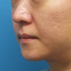 20150312_110446.JPG