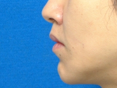 2010_0928_190950AA.JPGのサムネール画像