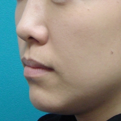 2011_0214_010151AA.JPGのサムネール画像