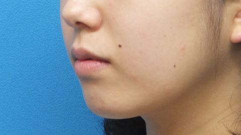 2016_0304_130847AA.JPG