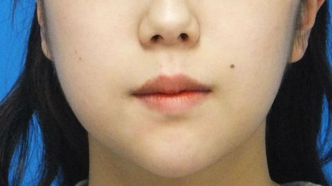 2016_0415_012512AA.JPG
